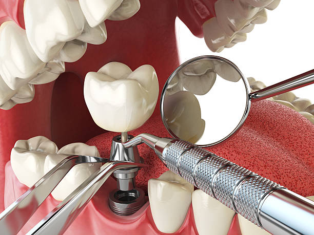 Best Emergency TMJ Treatment in Newmanstown, PA